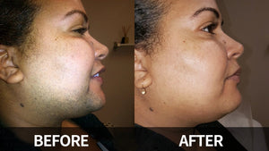 SoftSilk Pro - Painless Facial Hair Remover – Hydrating & Gentle