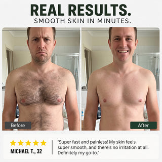 tryskintle  Hair Removal Cream