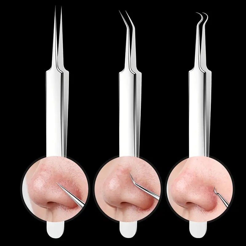 UltraClean - Professional Blackhead Remover Tweezers