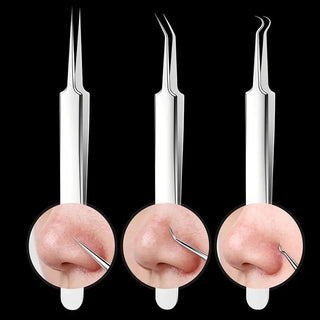 UltraClean - Professional Blackhead Remover Tweezers