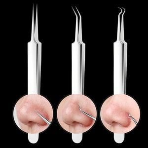 UltraClean - Professional Blackhead Remover Tweezers