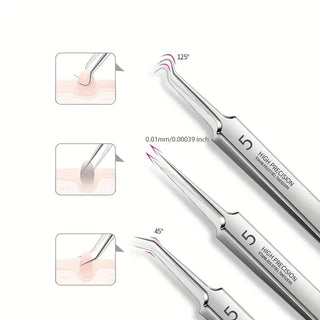 UltraClean - Professional Blackhead Remover Tweezers