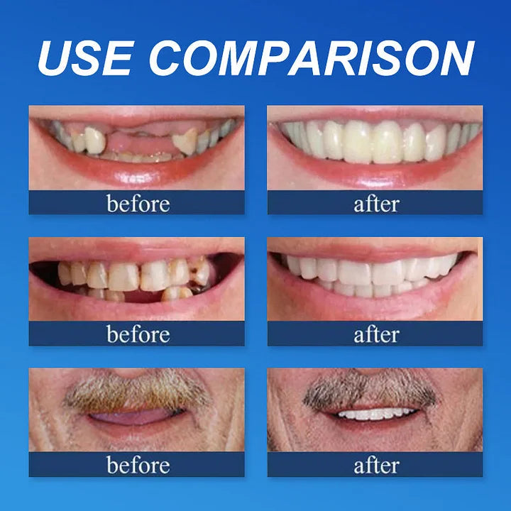 DentaGrip - Strong Suction Full Denture