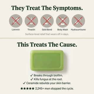 Tea Tree Antifungal Bar – Clears Fungal Infection and Skin Balance from the Root