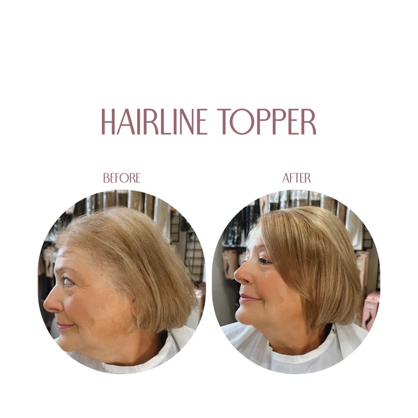 🎀Hairline Topper