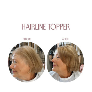 🎀Hairline Topper