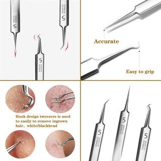 UltraClean - Professional Blackhead Remover Tweezers