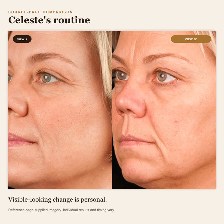 Reference-page comparison 5; individual results vary