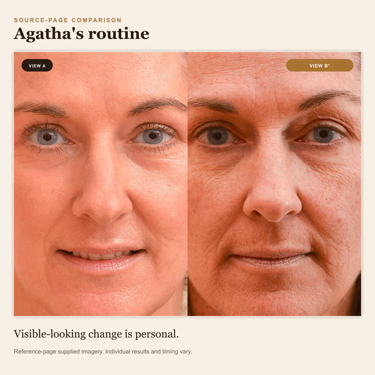 Reference-page comparison 4; individual results vary