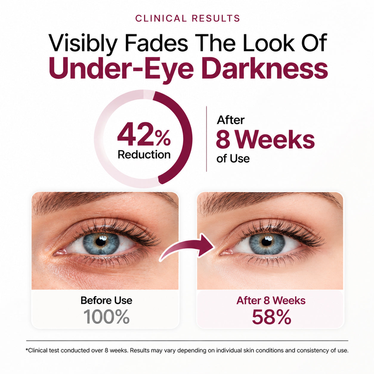 EyeRenew – 🔥🔥 P7 Eye Renewal Crème with Cooling, Red Light & EMS Applicator