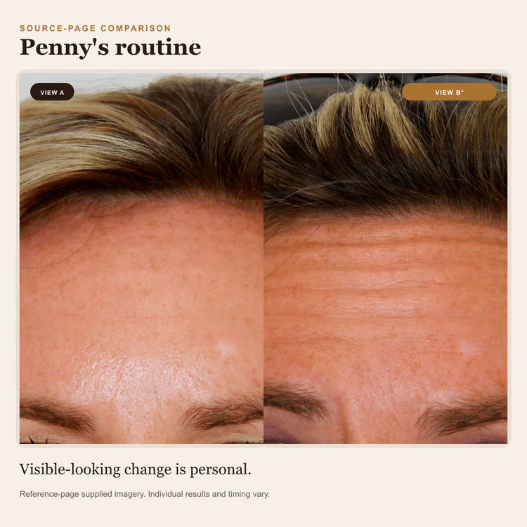 Reference-page comparison 11; individual results vary
