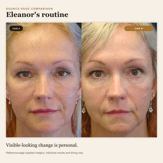 Reference-page comparison 10; individual results vary