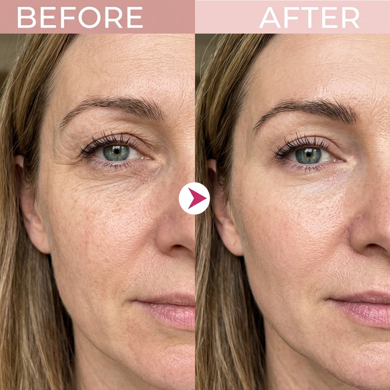 EyeRenew – 🔥🔥 P7 Eye Renewal Crème with Cooling, Red Light & EMS Applicator