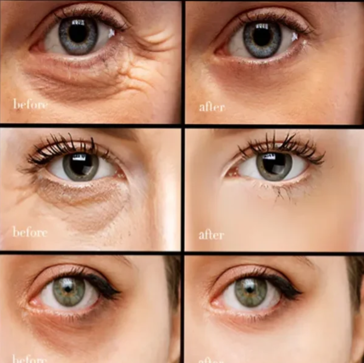 PerkGlow – Hydrating Caffeine Eye Cream For Wrinkles & Bags