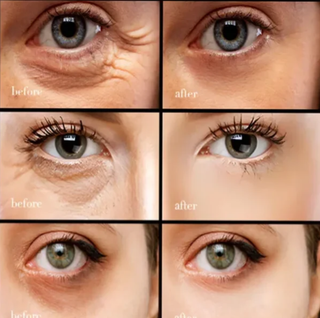 PerkGlow – Hydrating Caffeine Eye Cream For Wrinkles & Bags