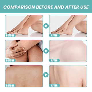 Gentle whitening