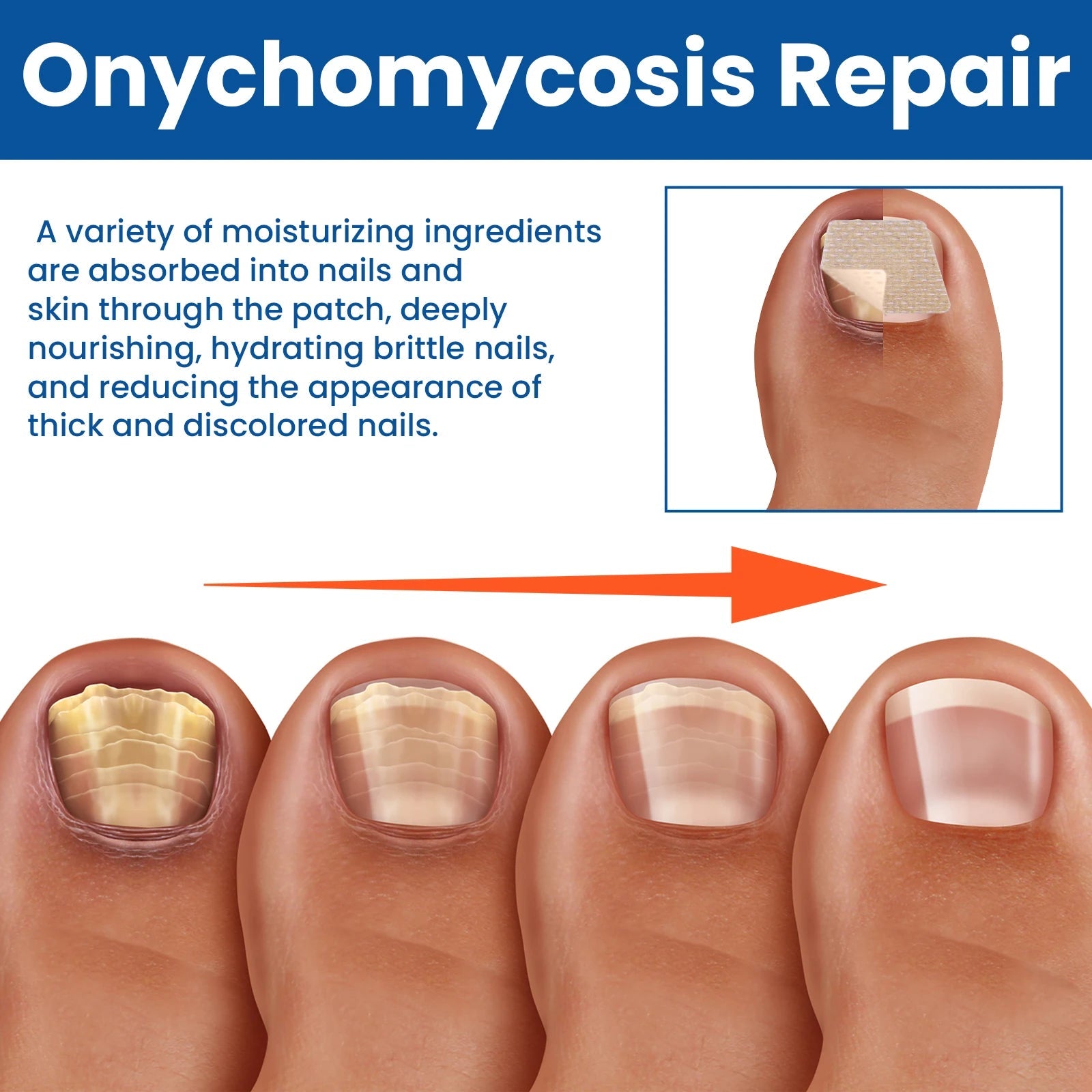 Fungal Nail Restoration Patches 60pcs