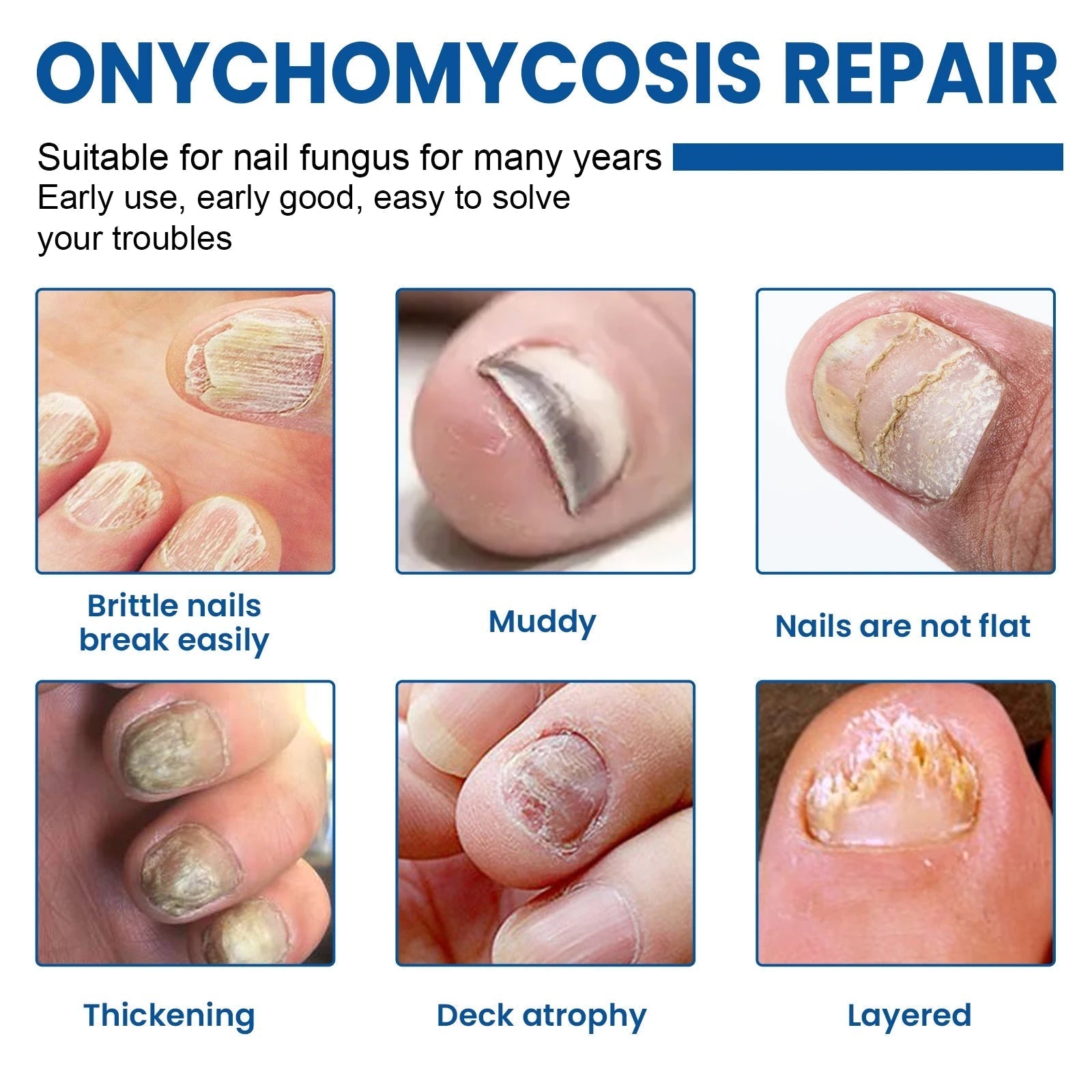 Fungal Nail Restoration Patches 60pcs