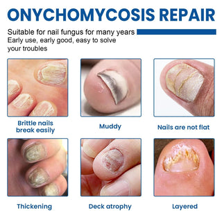 Fungal Nail Restoration Patches 60pcs