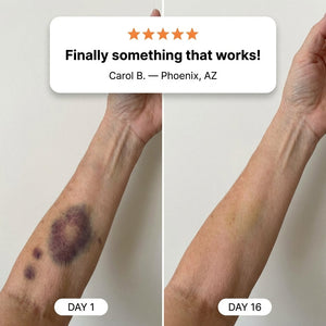 RenewaDerm - Skin Strengthening Cream