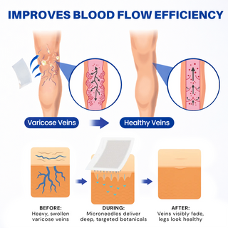 LegEase – Comfortable Vein Care Patch System