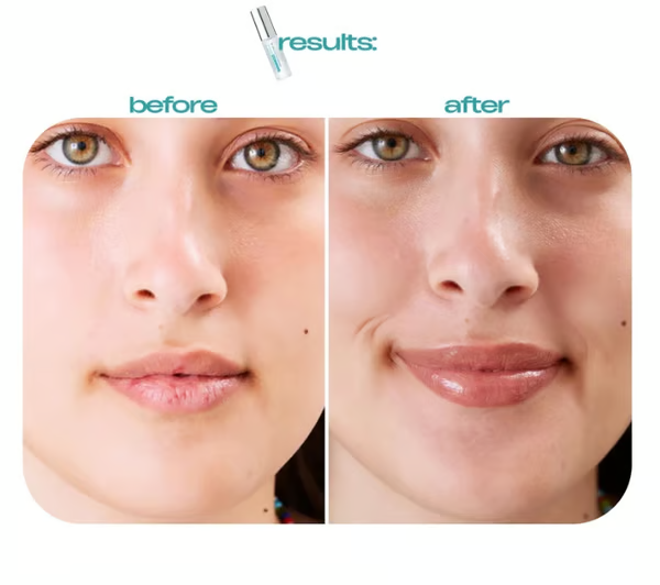 SpikeKiss – Advanced Lip Plumping Shot