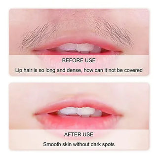 SilkErase – Gentle & Painless Facial Hair Removal Cream