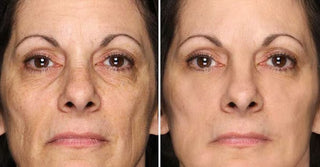 PowerRedo – Instant Wrinkle Repair Serum