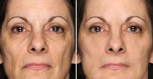 PowerRedo – Instant Wrinkle Repair Serum