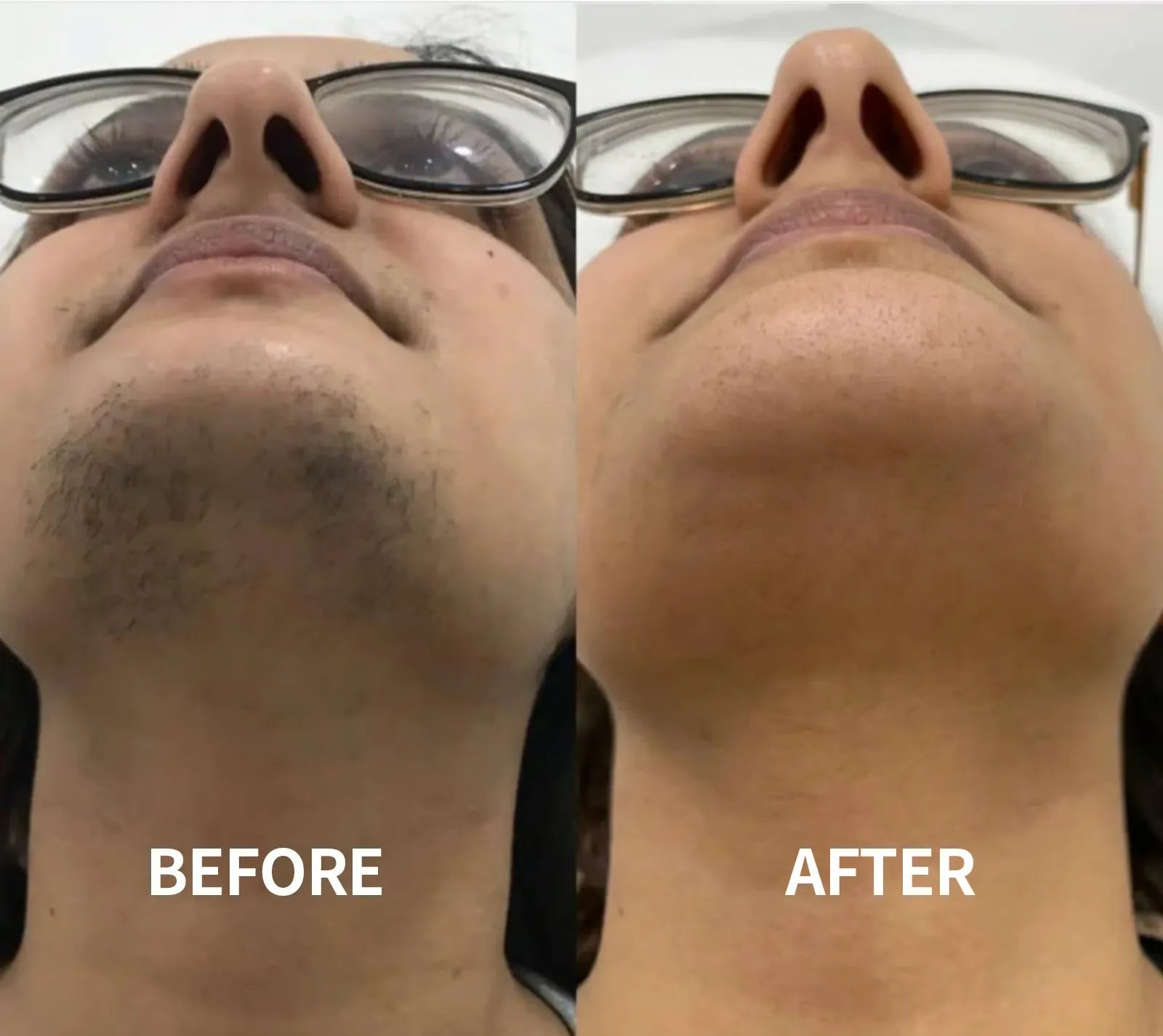 SilkErase – Gentle & Painless Facial Hair Removal Cream