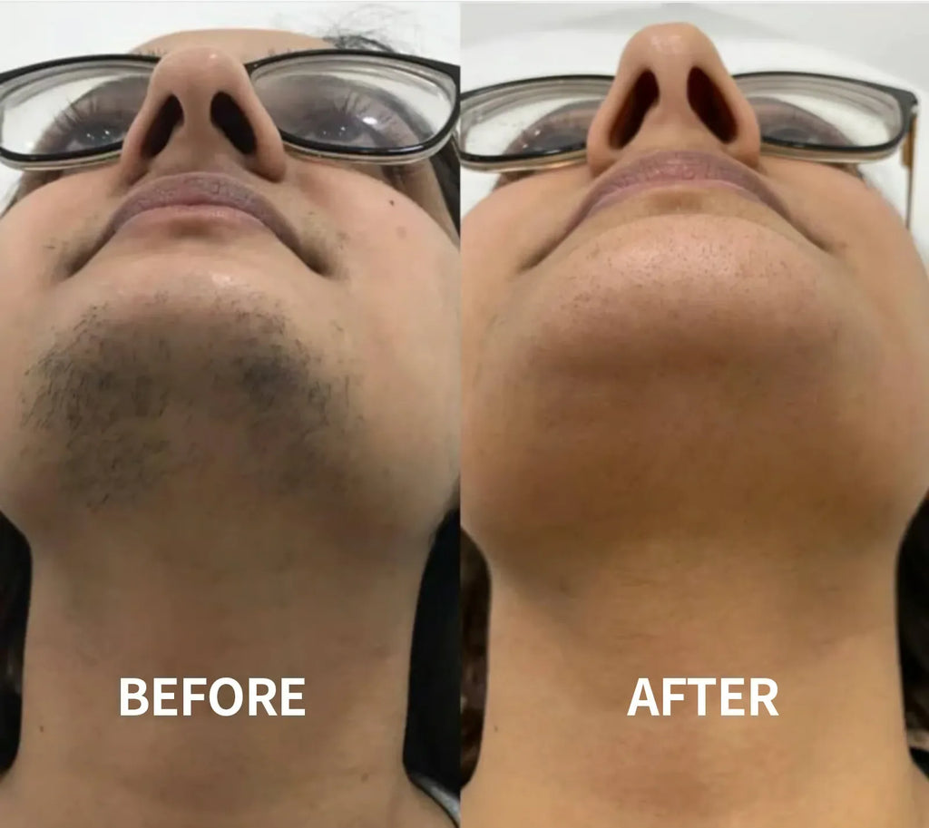 SilkErase – Gentle & Painless Facial Hair Removal Cream