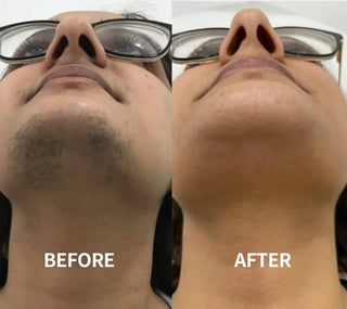 SilkErase – Gentle & Painless Facial Hair Removal Cream