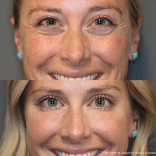 Brightify - Undereye Color Corrector for Instant Radiance