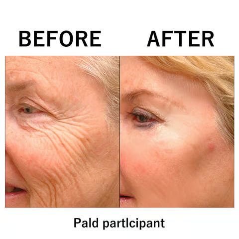 PowerRedo – Instant Wrinkle Repair Serum