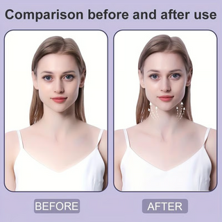 FacioFix – Professional Tape for Instant Facial Tightening