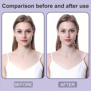 FacioFix – Professional Tape for Instant Facial Tightening