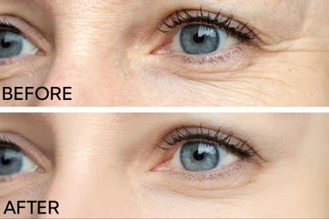 PowerRedo – Instant Wrinkle Repair Serum