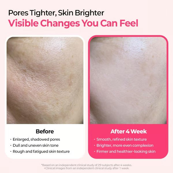 LumiGlow – Pore Refining & Spot Correcting Duo