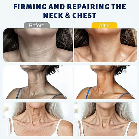 DermaRoll  – Neck Sculpting Lift Cream