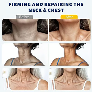 DermaRoll  – Neck Sculpting Lift Cream