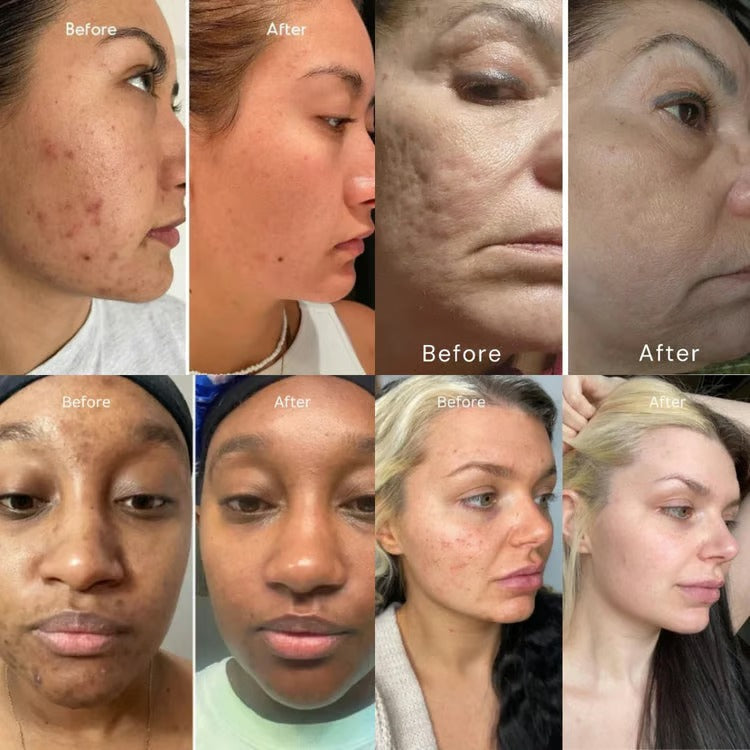 DermaRoll  – Neck Sculpting Lift Cream