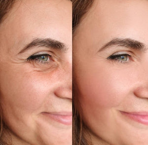 PowerRedo – Instant Wrinkle Repair Serum