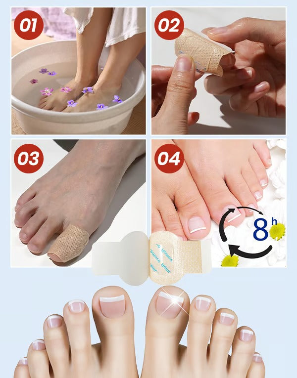 HealixNail – Antifungal Patch Therapy for Stronger Nails