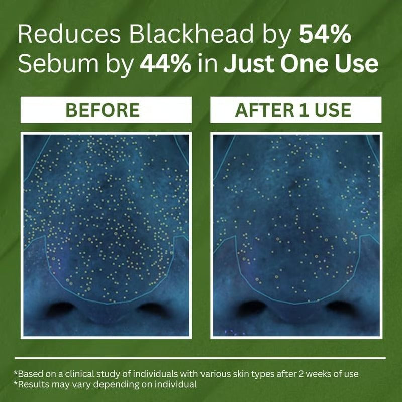 BasilWhisper – Purifying Bubble Mask