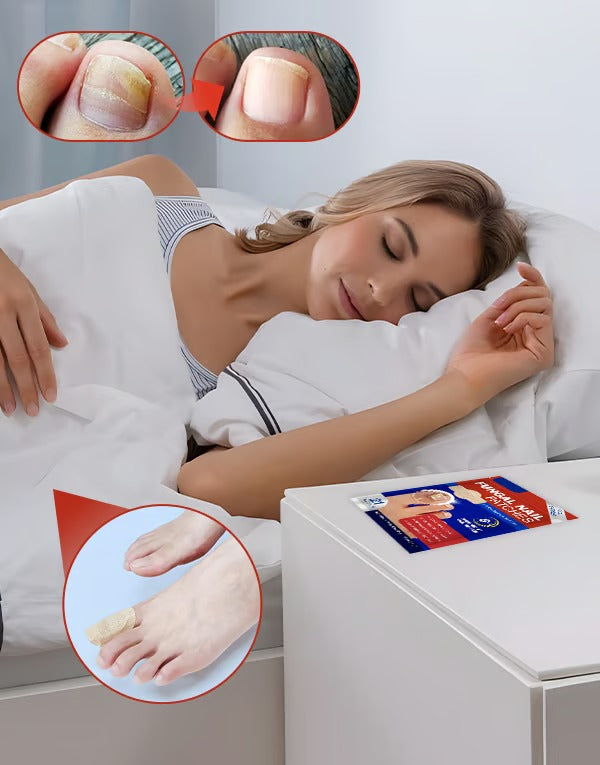 HealixNail – Antifungal Patch Therapy for Stronger Nails