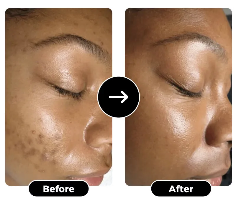 GlowRoot – Radiance Boosting Turmeric Soap