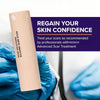ScarEase – Invisible Healing Silicone Stick