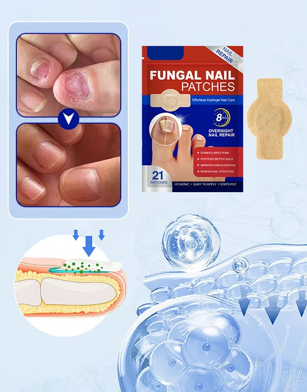 HealixNail – Antifungal Patch Therapy for Stronger Nails