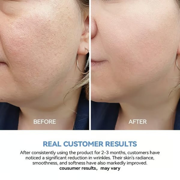 HydraBloom – Plant Powered Serum for Lasting Moisture