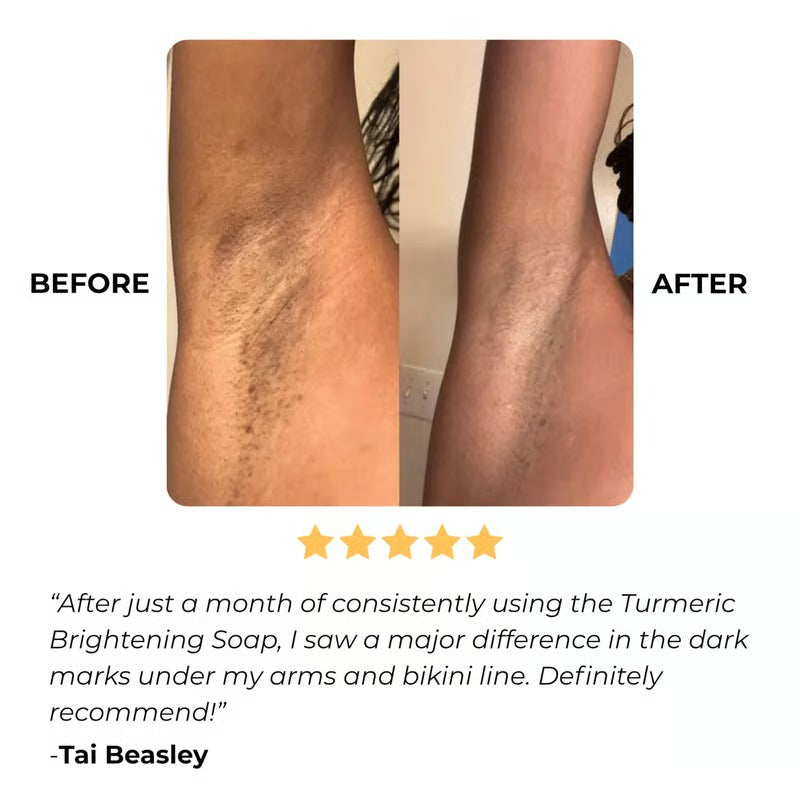 GlowRoot – Radiance Boosting Turmeric Soap